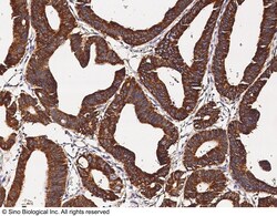 Sino Biological IGF2BP2/IMP2 Antibody, Rabbit PAb, Antigen Affinity Purified