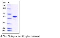Sino Biological Recombinant Human GAPDH Protein (His Tag), Quantity: Each