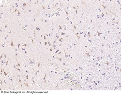 Sino Biological Anti-B4GALNT1 Antibody, Rabbit Polyclonal, Quantity: Each