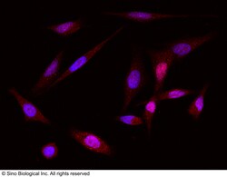 Sino Biological MKK6 / MEK6 / MAP2K6 Antibody, Rabbit PAb, Antigen Affinity