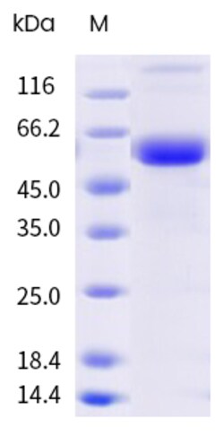 Sino Biological&nbsp;Recombinant Human IL-25/IL-17E Protein (hFc Tag), Biotinylated 100 µg