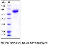 Sino Biological Recombinant Human IL-25/IL-17E Protein (hFc Tag) 500 µg,