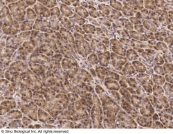 Sino Biological Anti-JNK2 Antibody, Rabbit Polyclonal, Quantity: Each of