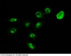 Sino Biological MECP2 Antibody, Rabbit PAb, Antigen Affinity Purified 100uL,