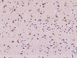 Sino Biological MAP1 Antibody, Rabbit PAb, Antigen Affinity Purified 100uL,