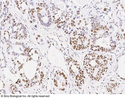 Sino Biological Recombinant Anti-MSH6 Antibody, Rabbit Monoclonal, Quantity:
