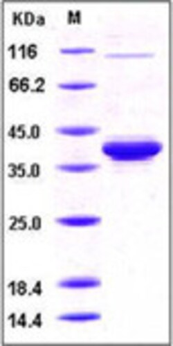 Sino Biological Human IL-8 / CXCL8 Protein (aa 23-99, Fc Tag) 100ug, Quantity: