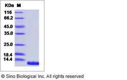 Sino Biological Recombinant Human IL-8/CXCL8 Protein (His Tag), Quantity: