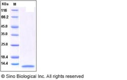 Sino Biological Recombinant Human IL-8/CXCL8 Protein (aa 28-99), Quantity: