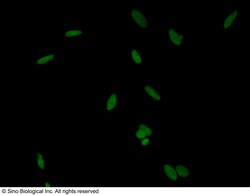 Sino Biological PARP-1 / PARP Antibody, Rabbit PAb, Antigen Affinity Purified