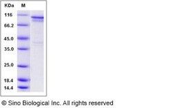 Sino Biological Recombinant Human S6K1/RPS6KB1 Protein (GST Tag), Quantity: