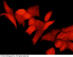 Sino Biological Anti-S6K1/RPS6KB1 Antibody, Rabbit Polyclonal, Quantity: