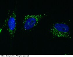 Sino Biological Anti-PML Antibody, Rabbit Polyclonal, Quantity: Each of