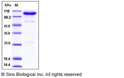 Sino Biological Human CD55 / DAF Protein (Fc Tag) 100ug, Quantity: Each