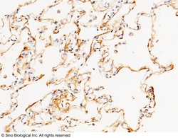 Sino Biological Anti-CD55/DAF Antibody, Rabbit Polyclonal, Quantity: Each