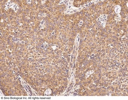 Sino Biological Anti-UBE4A Antibody, Rabbit Polyclonal, Quantity: Each