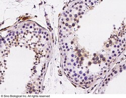 Sino Biological Anti-PKC alpha/PRKCA Antibody, Rabbit Polyclonal, Quantity: