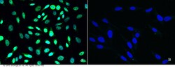 Sino Biological Anti-PRMT6 Antibody, Rabbit Polyclonal, Quantity: Each