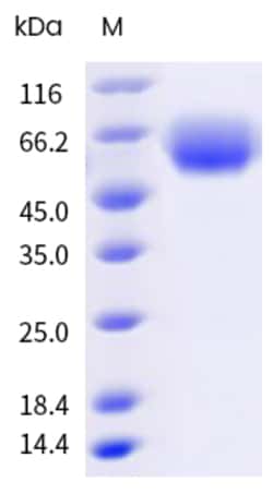 Sino Biological&nbsp;Recombinant Human ST2/IL-1 RL1 Protein (His Tag), Biotinylated, HPLC-verified 20 µg