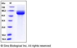 Sino Biological Human IL1RL1 / ST2 Protein (His Tag) 100ug, Quantity: Each