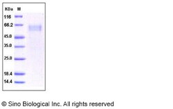 Sino Biological Recombinant Human ST2/IL-1 RL1 Protein, Quantity: Each