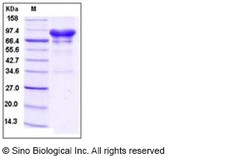 Sino Biological Recombinant Human Carbonic Anhydrase IX/CA9 Protein (hFc