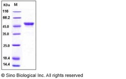Sino Biological Human Carbonic Anhydrase IX / CA9 Protein (His Tag) 100ug,