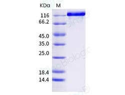 Sino Biological Human ACE2 / Angiotensin-Converting Enzyme 2 Protein (Fc