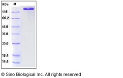 Sino Biological Human ACE2 / Angiotensin-Converting Enzyme 2 Protein (Fc