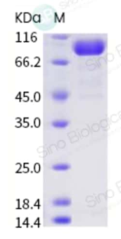 Sino Biological Human ACE2 / Angiotensin-Converting Enzyme 2 Protein (His
