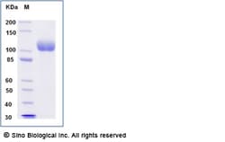 Sino Biological Recombinant Human ACE2 Protein (His Tag), HPLC-verified,