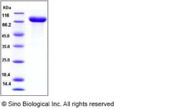 Sino Biological Recombinant Human IL1R2 Protein (hFc Tag), Quantity: Each