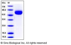 Sino Biological Recombinant Human IL1R2 Protein (ECD, His Tag), HPLC-verified,