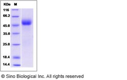 Sino Biological Human IL1R2 / IL1RB / CD121b Protein 100ug, Quantity: Each