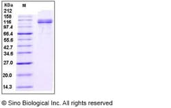 Sino Biological Recombinant Human VCAM-1/CD106 Protein (ECD, hFc Tag),
