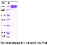 Sino Biological Human VCAM-1 / CD106 Protein (His Tag) 100ug, Quantity: