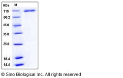 Sino Biological Recombinant Human VCAM-1/CD106 Protein (His Tag), Quantity: