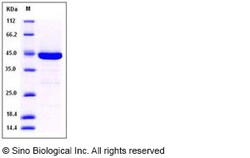 Sino Biological Recombinant Human DUSP3 Protein (His & GST Tag), Quantity: