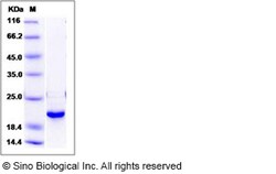 Sino Biological Human DUSP3 / VHR Protein 100ug, Quantity: Each of 1