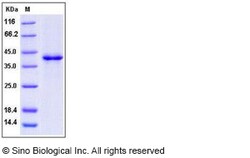 Sino Biological Recombinant Human SDF-1/CXCL12 Protein (hFc Tag), Quantity:
