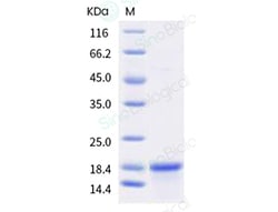 Sino Biological Recombinant Human IL-18 Protein, HPLC-verified, Quantity: