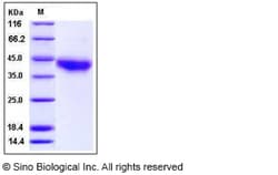 Sino Biological Recombinant Human JAML/AMICA Protein (His Tag), HPLC-verified,