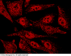 Sino Biological Anti-KEAP1 Antibody, Rabbit Polyclonal, Quantity: Each