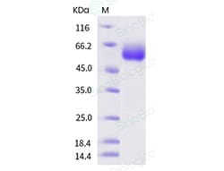 Sino Biological Recombinant Human IL1RAP/IL-1RAcP Protein (His Tag), HPLC-verified