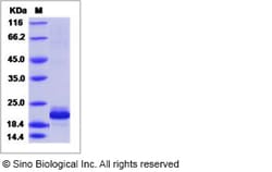 Sino Biological Recombinant Human IL-38/IL1F10 Protein (His Tag) 1 mg,