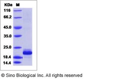 Sino Biological Recombinant Human IL-38/IL1F10 Protein (His Tag), Quantity: