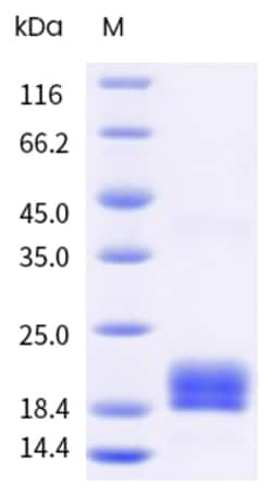 Sino Biological&nbsp;Recombinant Human IL-1RA/IL-1RN Protein, Biotinylated 100 µg