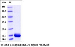 Sino Biological Recombinant Human IL-36 gamma/IL-1 F9 Protein (aa 18-169,