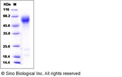 Sino Biological Recombinant Human IL1R1 Protein, Quantity: Each of 1