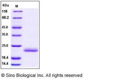Sino Biological Recombinant Human IL-1 alpha/IL1A Protein, Quantity: Each